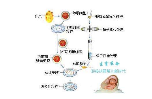 重庆最有名的供卵试管医院