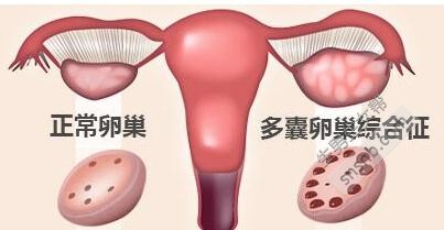 实验室供卵做试管多少毫升