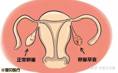 在重庆市重庆代怀孩子双胞胎婴儿成功率怎么样